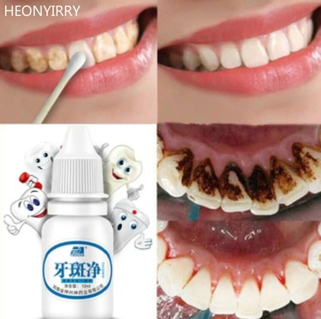 Image of 10ml Teeth Whitening Water Oral Hygiene Cleaning Teeth Care