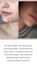 Image 2 of CLEAR + CORRECT Facial Serum