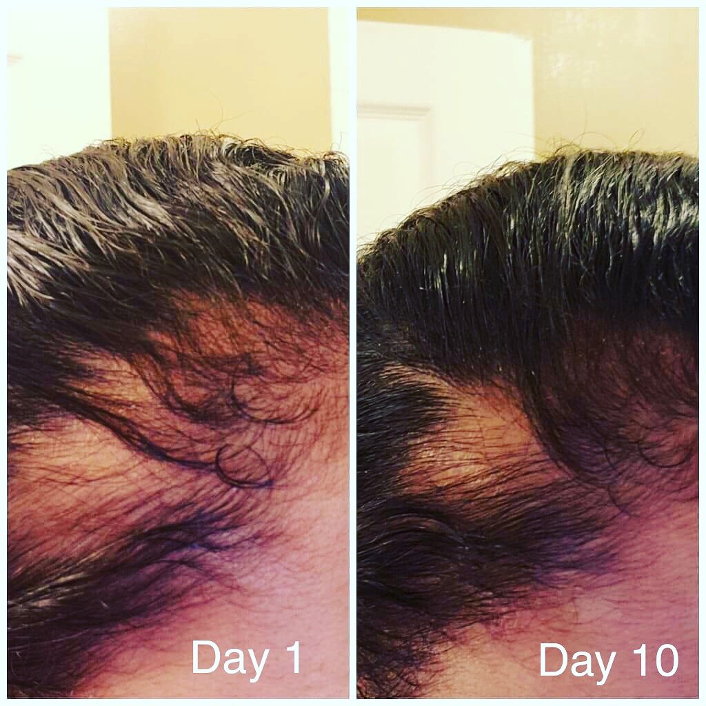 Image of Category: Extreme Hair Regrowth Elixir Systems