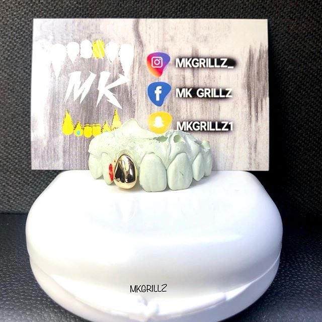 Image of Single Solid Gold Cap