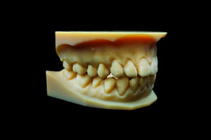 Image of Typodont Model Set
