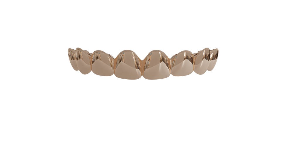 Image of 8 Top Teeth Solid 10k Gold