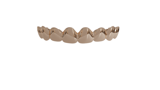 Image of 8 Top Teeth Solid 14k Gold Grills