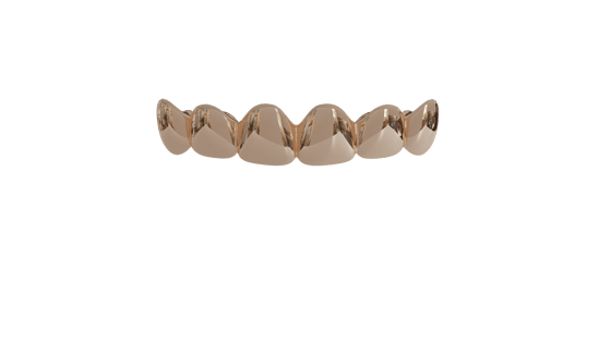 Image of 6 Top Teeth Solid 10k Gold Grills