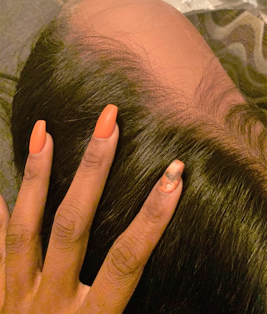 Image of HD frontals