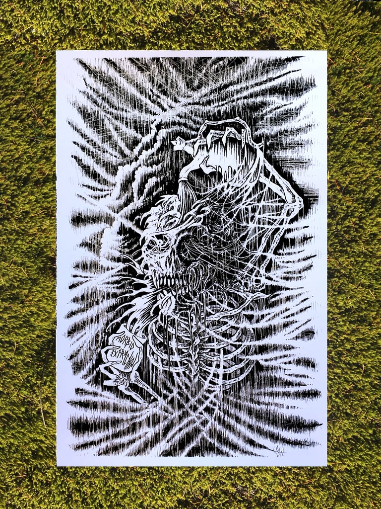 STM002 - MORBID EXTRACTION