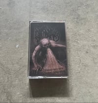 Image 1 of Gargling Depraved Ingestion of Cranial Discharge