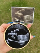 Image 4 of Custom Ultrasound Embroidery Hoop