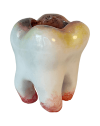 Image 3 of Decaying Tooth holder