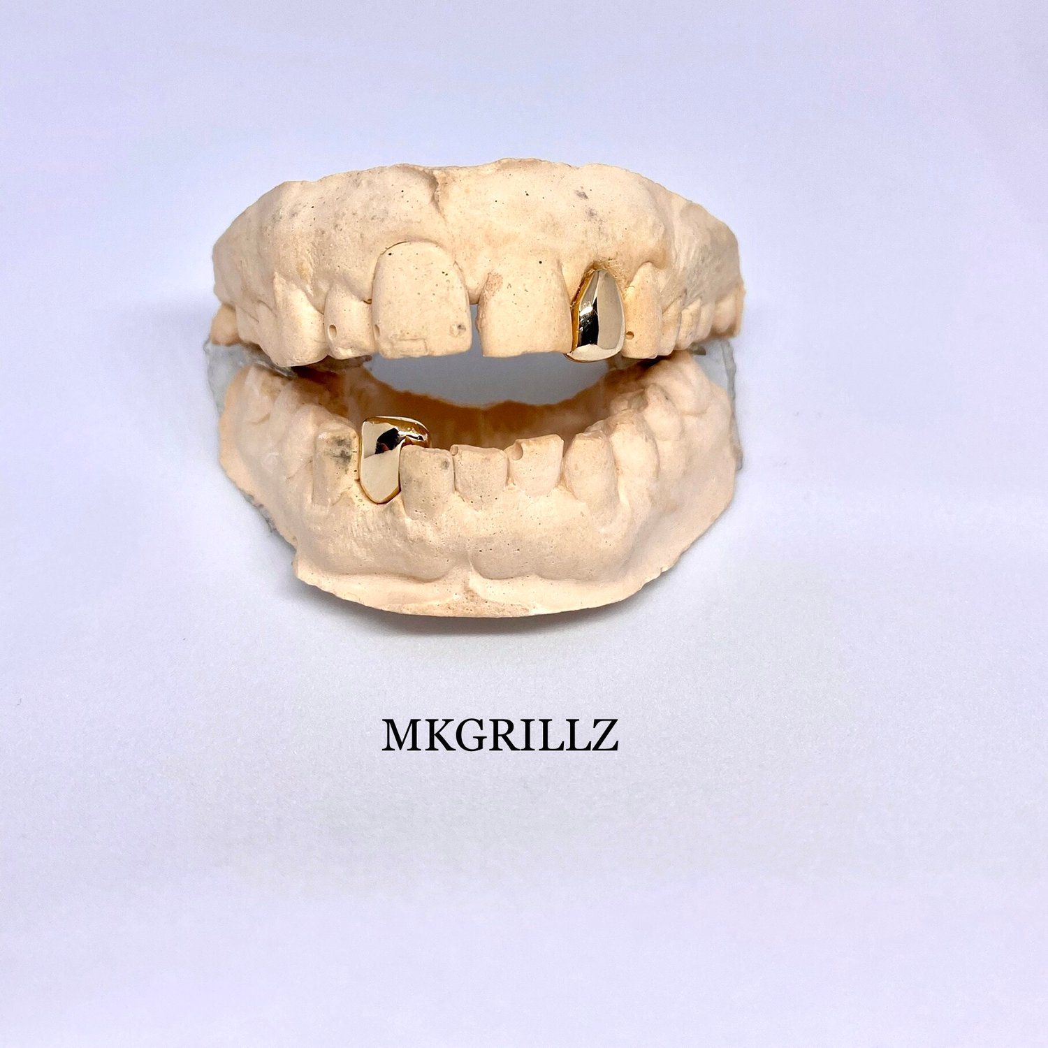 Image of Double Solid Gold Teeth caps