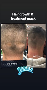 Image of 2 oz. Hair Growth & Treatment Mask ♥️