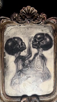 Image 3 of 'SIAMESE TWINS' [ Unique Print - { 1/1 } ] Hand Embellished Museum Archival Print 
