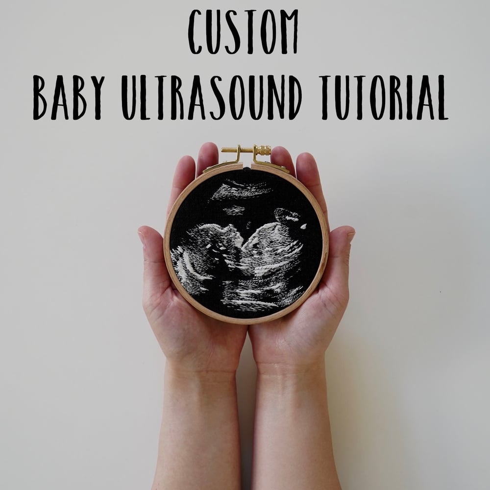 Image of Baby Ultrasound Tutorial