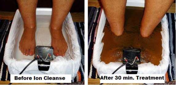 Image of Foot Detoxification session