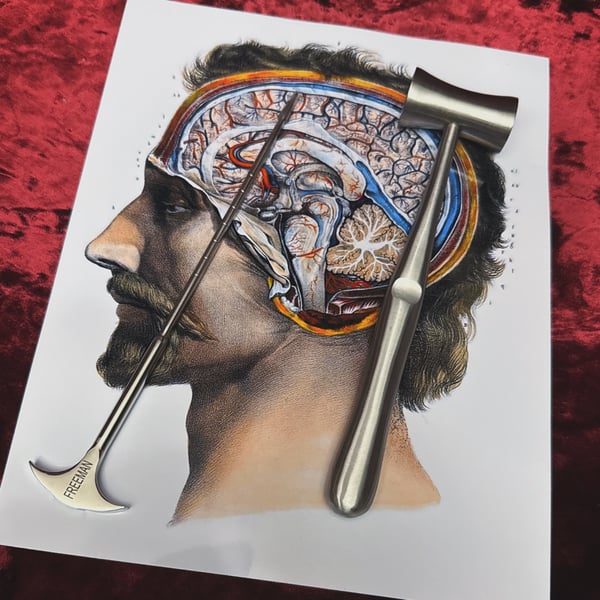 Image of Lobotomy Tool Set