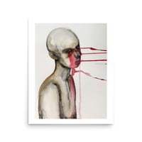 The ache in my chest won't leave (print)