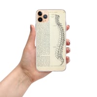 Image 4 of Vintage Book Page Anatomical Illustration Human Spine Clear Case for iPhone®