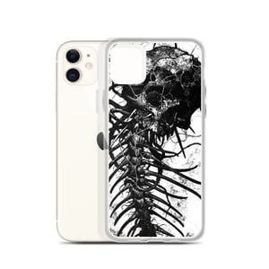 BONES iPhone Case