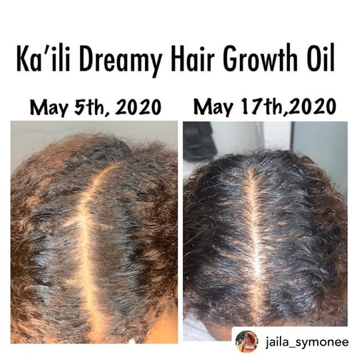 Image of Ka’ili Dreamy Hair Growth Oil