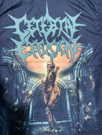 Image 3 of Cerebral Effusion