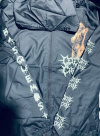 Image 4 of Cerebral Effusion