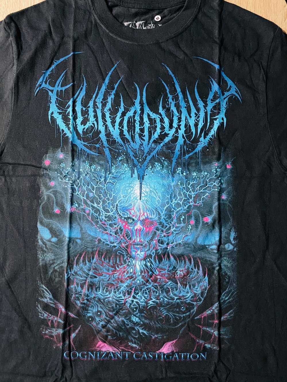 Vulvodynia