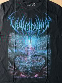 Image 3 of Vulvodynia