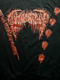 Image 3 of Hymenotomy