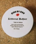 Eczema body butter