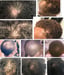 Image of Woke Hair Growth Stimulant