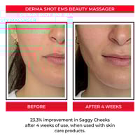 Image 6 of EMS Microcurrent Roller Skin Tightening