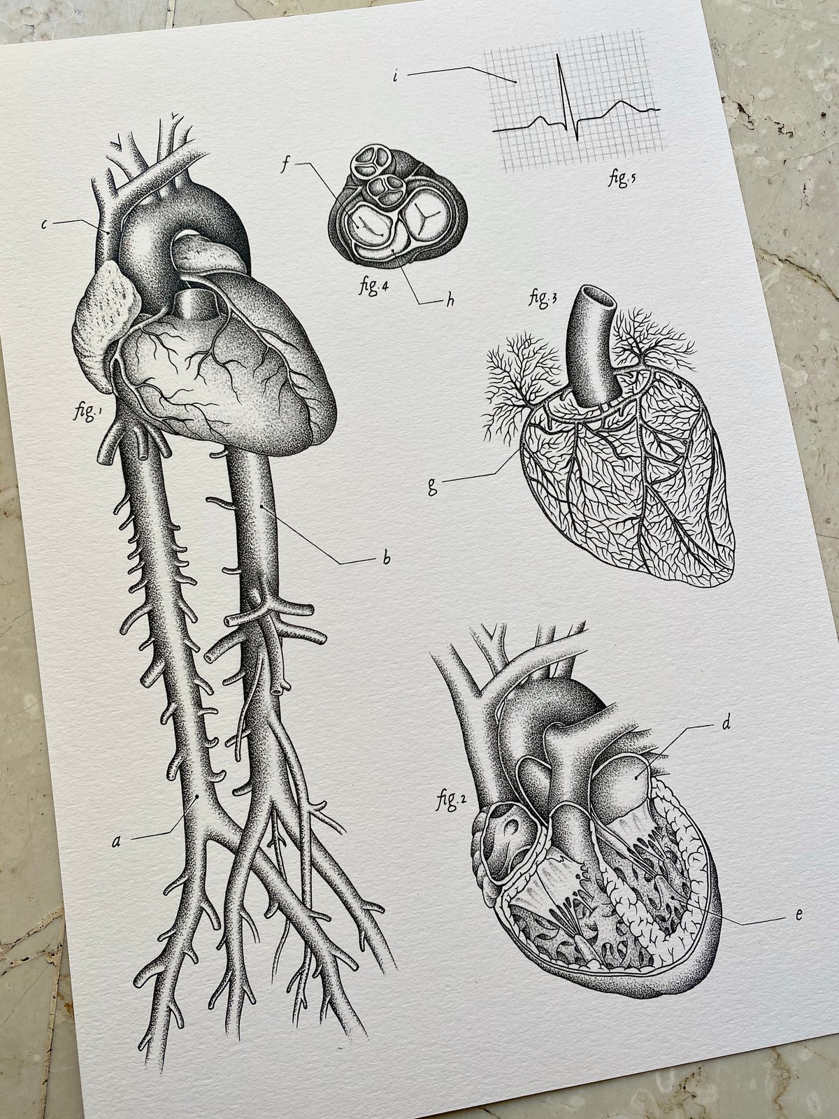 (A3/A4 SIZE) HEART-THEMED ANATOMICAL PLATE