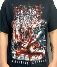 Image 2 of Severe Torture - SS