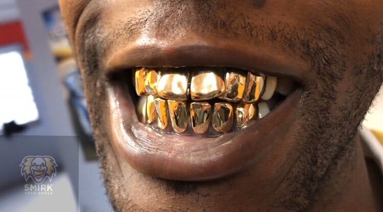 Gold grillz on sale