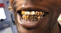 Image 1 of 14K Gold Grillz