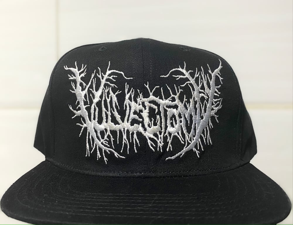 Vulvectomy (snapback)