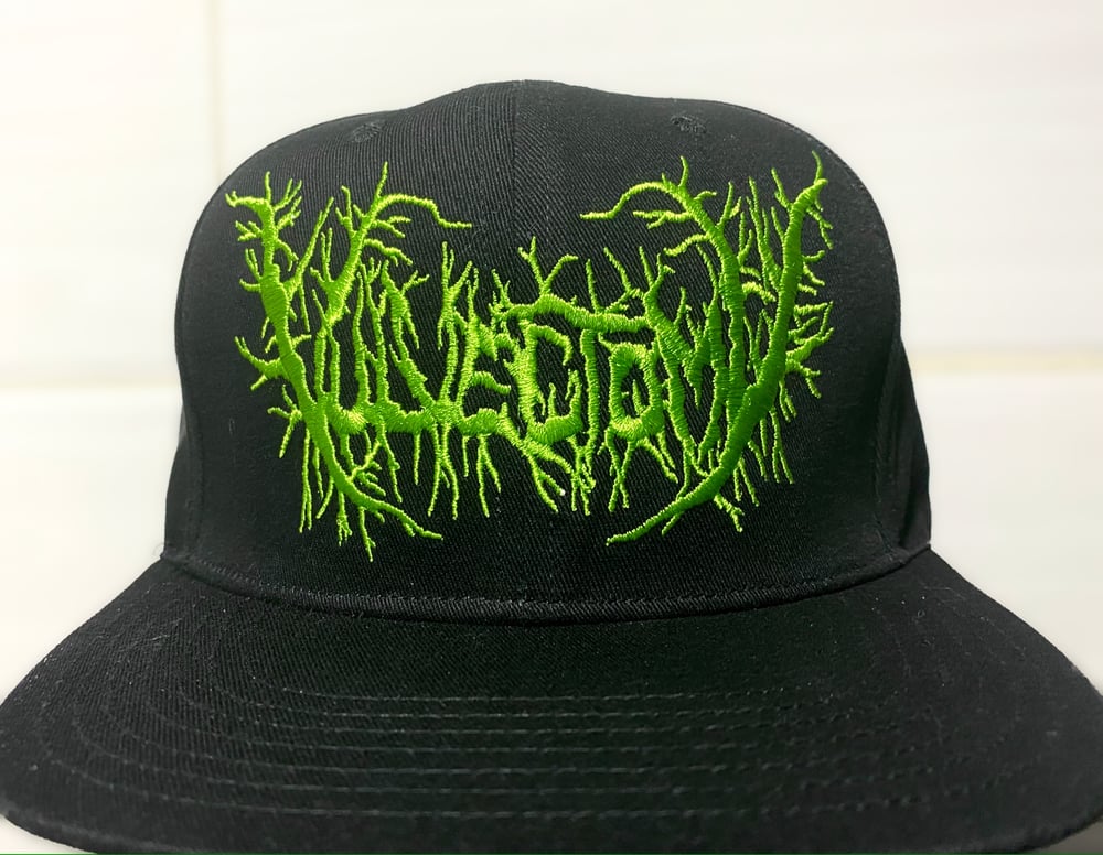 Vulvectomy (snapback)