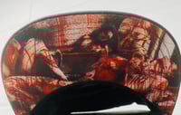 Image 3 of Vulvectomy (snapback)