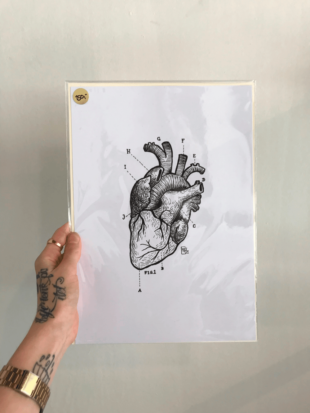 Image of Anatomic Heart x Print