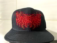 Image 1 of Syphilectomy