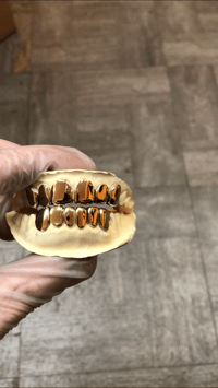 Image 2 of 18K Gold Grillz