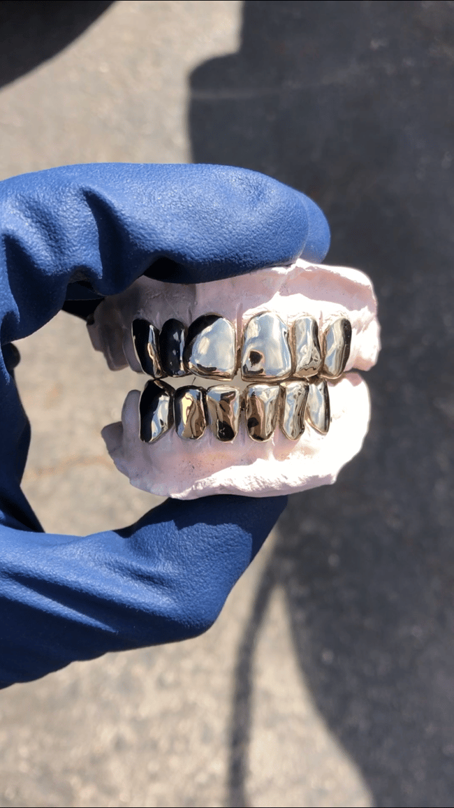 10K GOLD GRILLZ SmirkGoldGrillz