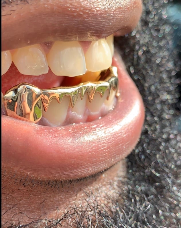 14K Gold Grillz | SmirkGoldGrillz