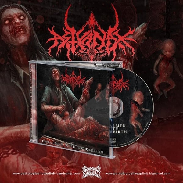 Image of “Embalmed with Afterbirth” Reissue CD 
