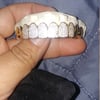 Custom Grillz