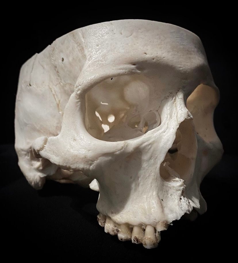 Image of Real Human Skull 