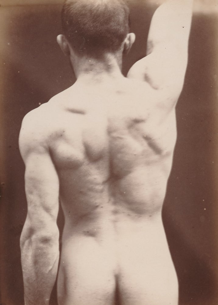 Image of  Paul Richer: "Le bras levé verticalement", ca. 1890