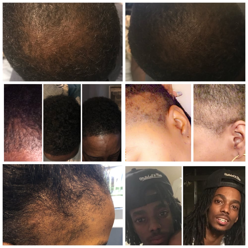 Hair Growth Serum 2oz
