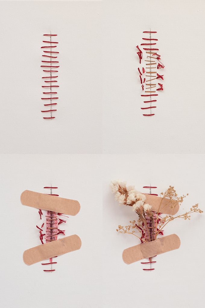 Image of Print PROCESO SANACIÓN DE UNA HERIDA