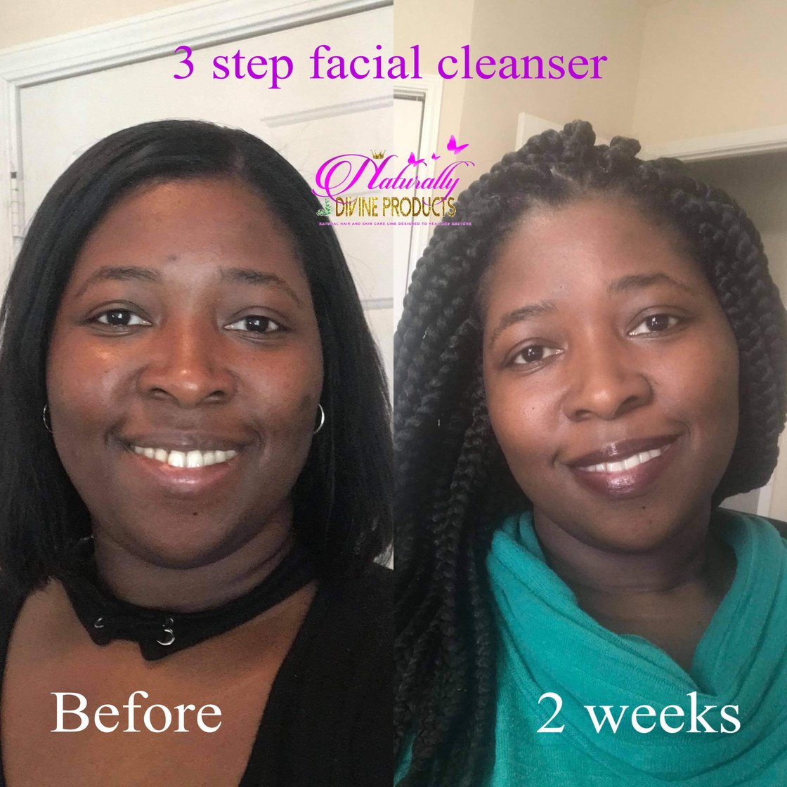 Image of Category: Facial Systems